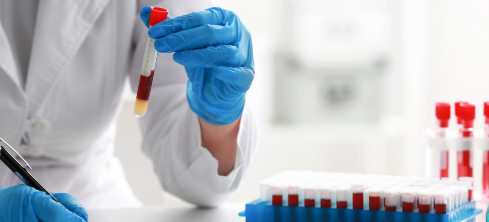 Heat Skews Blood Tests