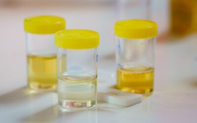 BriteDot urine temperature indicators: A practical, SAMHSA-aligned approach to specimen temperature monitoring